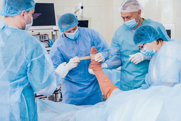 Varicose operation